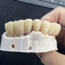 인생플란트 치과기공소 이미지