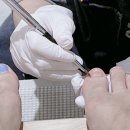[분당 내성발톱 / 분당 발톱무좀] &#34;정원뷰티끄서현점&#34;에서 엄지발톱 무좀치료하고 온 후기