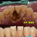 서울민플러스치과 이미지