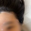 [평택] 평택 고덕 왁싱 맛집 하양슈가왁싱 : 저자극 천연성분 민감성 피부 헤어라인 왁싱 추천 솔직후기