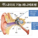 중이염.메니에르병의 치료법 이미지