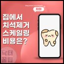 집에서 잇몸 치석제거 방법 및 용인 치과 비용은?