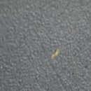 주식회사 이루고 | 키오스킨 디판테놀 15.5크림 효과 위주 관찰 일지 솔직후기 ( + 여드름 사진 첨부 )