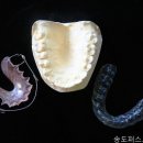 현대치과의원 네이버블로그