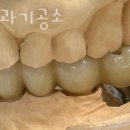 큐브치과기공소 이미지