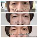노화의 시계를 되돌리는 지쿱 케어셀라 아이퍼프 한달 사용후기~***-****-****
