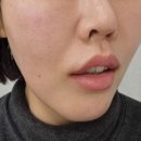 청담란셀의원 이미지