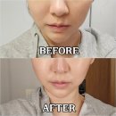 이주연 | 일산 식사동피부관리 이주연스킨케어 윤곽관리 후기