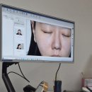 현대한의원 | 해운대센텀시티역 한의원 아이볼뉴머 눈가주름 관리 후기