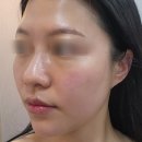 MK웨딩 | [순천 피부관리 윤곽관리 웨딩관리 얼굴균형관리 수기...결국 회원권까지! MK뷰티 솔직 후기