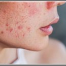 바른샘한의원 이미지