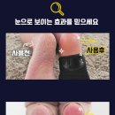 힐링풋