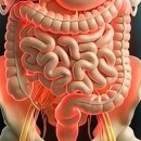 서경식품 | 유산균을 먹지 말아야 하거나 주의해야 하는 사람들