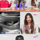 나는 솔로 28기, 종방 전 임신소식. 이미지