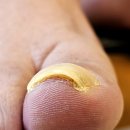 당신의네일 이미지