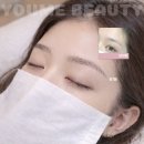 서부안심생존센터 | 강남역눈썹 반영구문신 유미코리아 뷰티센터 7일 경과 후기