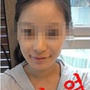 안면슈퍼 이미지
