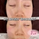 피부;피어나리