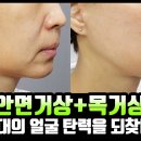 50대 얼굴 맞나요? 주름과 탄력까지 잡은 안면거상+목거상 디테일 전후비교 영상! 이미지