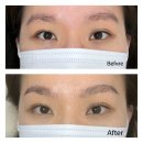 메디칼왕약국 | 노원 맞춤상담 속눈썹펌 브로우펌 추천 <뷰티포레> I 주차가능, 당일 주말 예약 가능