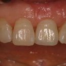 쌍용치과기공소 이미지