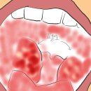 공덕연세이비인후과의원 이미지