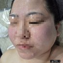 메디플렉스 세종병원 | 여주 피부샵 ㅣ메디스킨 유리하 V라인 리프팅 솔직후기