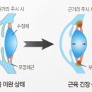 미르안경 이미지