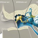 서울난청센타 이미지
