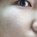 리뉴메디 직접 구입 후 피부관리 시작했어요.