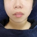 [춘천] 더나은뷰티 :: 춘천 윤곽리프팅 피부관리 All 토탈샵 / 남춘천역 근처 뷰티샵 후기