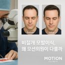 모션의원 이미지