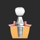 소중한이치과 이미지