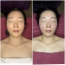 스트레스 받은 피부에 휴식을! 창원피부관리의 명소, 생크몽드 스파앤요가