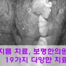 곤지름 치료, 보명한의원의 19가지 다양한 치료법 이미지