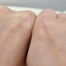 아텐 | 속광 채우는 아루네 올레아텐 앰플 내돈내산 올레샷 후기