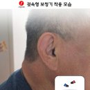 시그니아독일보청기 이미지
