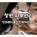 올메디 | 창원 시티세븐 피부관리 에스테틱 ‘잇츠메디올스킨케어라운지’ 리얼후기