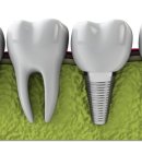 서울새로이치과의원 이미지