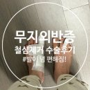 정도 | 무지외반증 핀제거 수술 당일퇴원 후기(비용, 통증 정도)