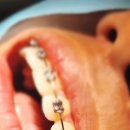 가지런이치과교정과치과의원 이미지