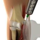문영래 정형외과병원 이미지