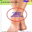 직장 부근에 잔변이 남아 있어서 어찌해야 하나요? 이미지