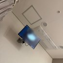 임신 준비 2. 나팔관 조영 초음파 솔직 후기 ෆ 통증 및 비용 · 서연아이여성의원