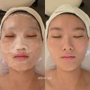 이끌림샵 | 풍무동 피부관리샵 이끌림스킨앤바디에서 여름 피부관리 모공케어 받고 온 후기