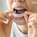 대구디지털치과기공소 | 대구교정전문치과 인비절라인 투명교정 시작 전 체크사항