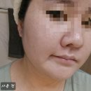 주식회사 셀트리온스킨큐어 | 블랙헤드클렌징오일 피지녹이는제품 셀트리온스킨큐어 추천 '한스킨 블랙헤드 클렌징오일 BHA'