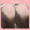 비프리티 이미지