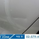 덴트존 이미지
