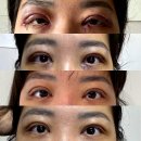 디자이너성형외과의원 | 압구정역 디자이너성형외과의원 정보 가는법